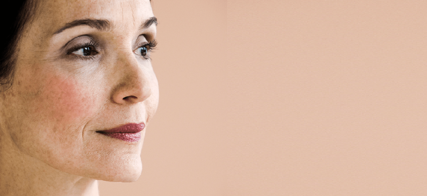 How to Treat Dark Spots