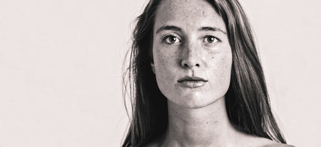 Why Is My Skin Sensitive?